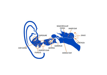 What Causes Ear Infections